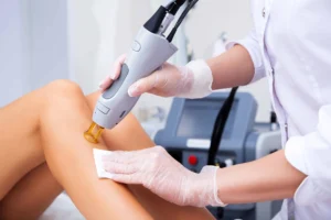 Laser Hair Removal with Aerolase Laser