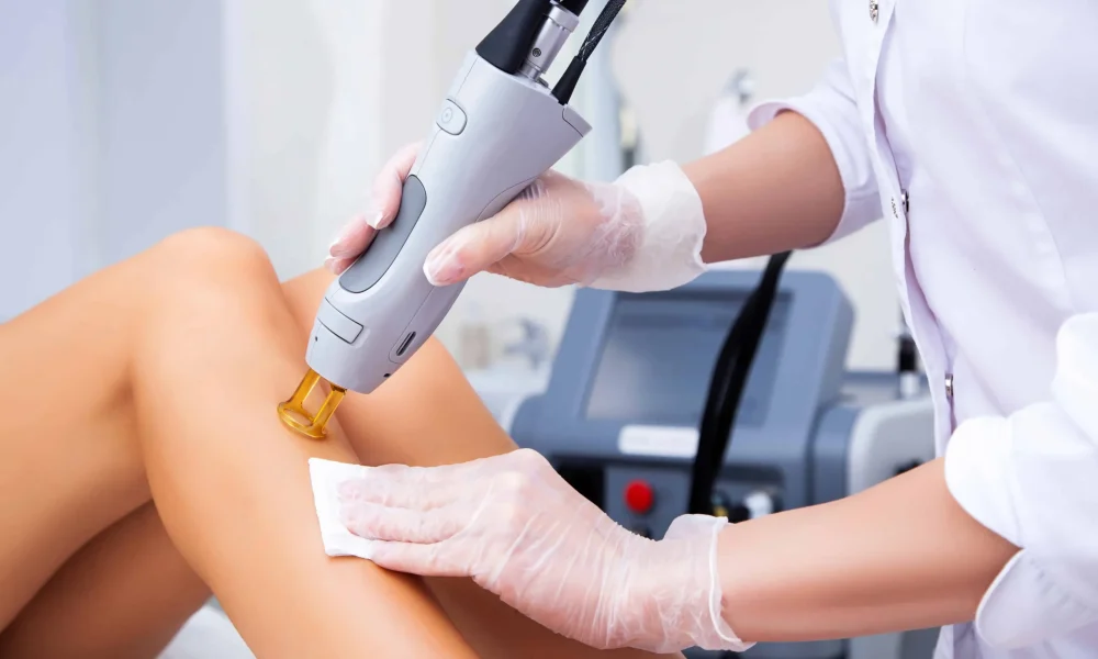 Laser Hair Removal with Aerolase Laser