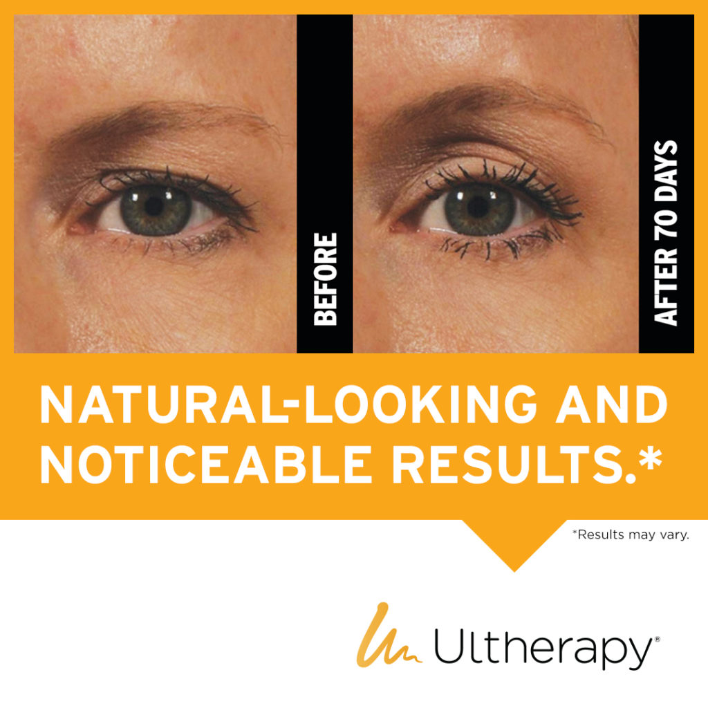 Ultherapy Grandbeautyaesthetics